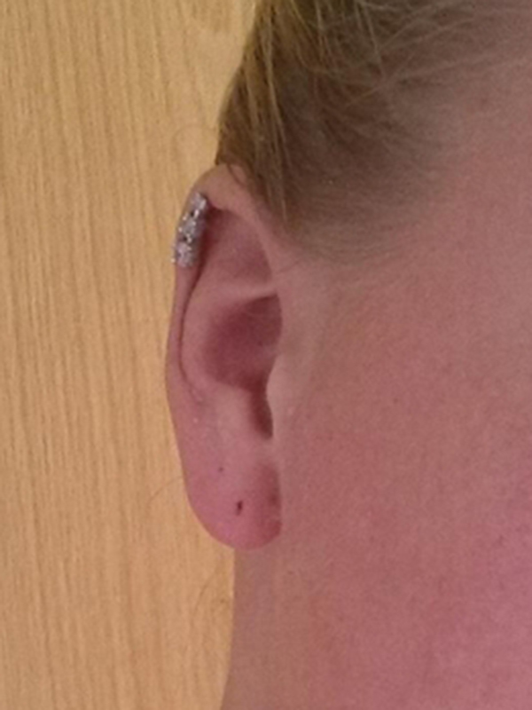  Helix-Piercing mit 3 quadratischen weißen Steinen