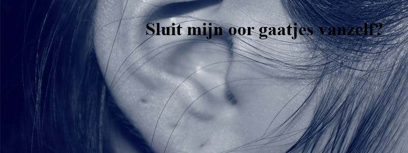 Sluit mijn oor gaatjes vanzelf? Sluit mijn oor gaatjes vanzelf?