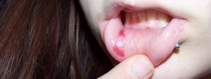 Piercings: Hoe voorkom je complicaties